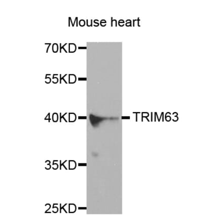 Western blot - TRIM63 antibody from Signalway Antibody (38580) - Antibodies.com