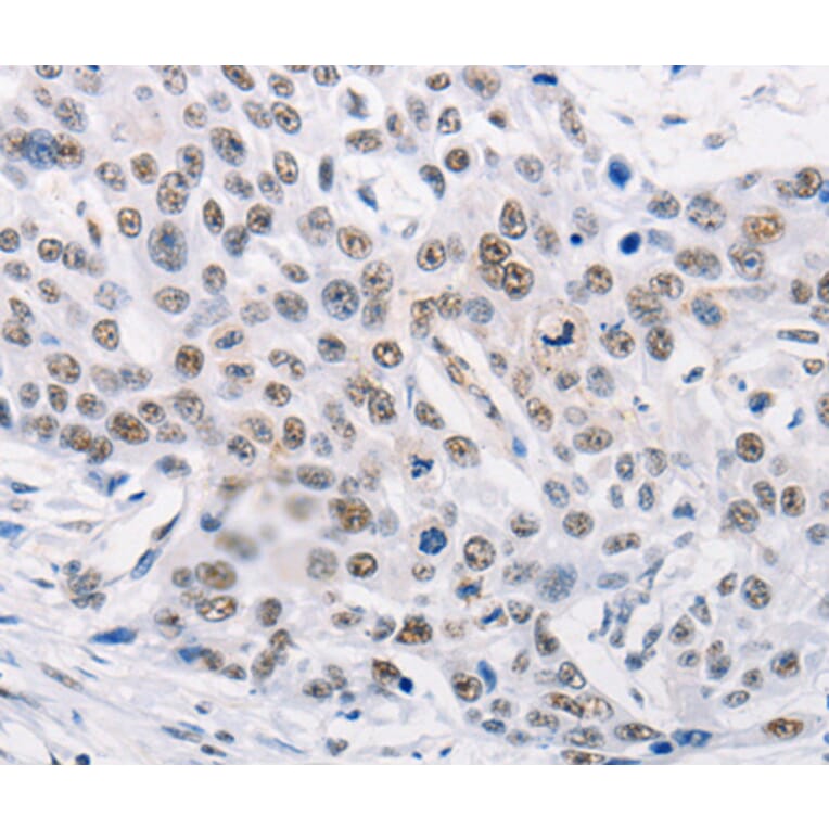 Immunohistochemistry - TRIM63 antibody from Signalway Antibody (38580) - Antibodies.com