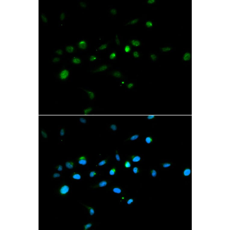 Immunofluorescence - TRIM63 antibody from Signalway Antibody (38580) - Antibodies.com