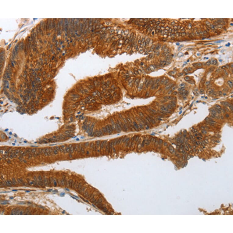 Immunohistochemistry - NOTCH3 antibody from Signalway Antibody (38587) - Antibodies.com