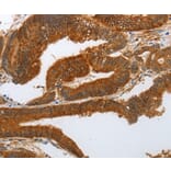 Immunohistochemistry - NOTCH3 antibody from Signalway Antibody (38587) - Antibodies.com