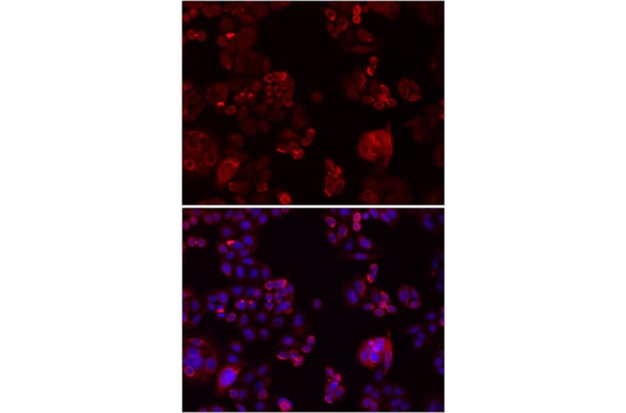 Immunofluorescence - NOTCH3 antibody from Signalway Antibody (38587) - Antibodies.com
