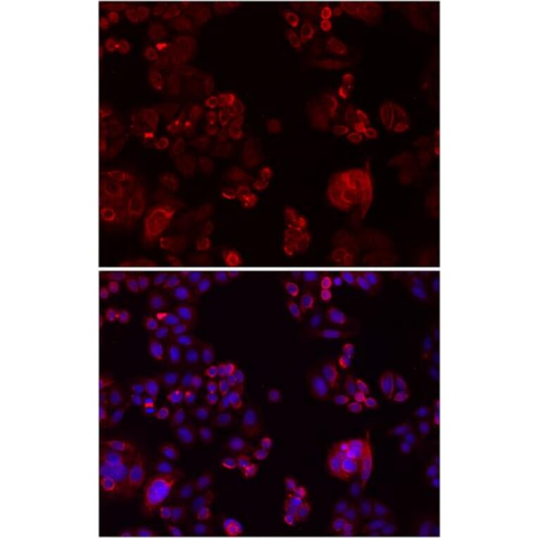 Immunofluorescence - NOTCH3 antibody from Signalway Antibody (38587) - Antibodies.com