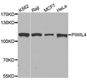 Western blot - PIWIL4 antibody from Signalway Antibody (38601) - Antibodies.com