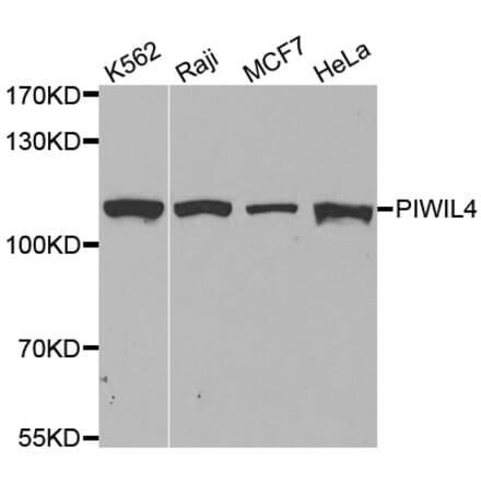 Western blot - PIWIL4 antibody from Signalway Antibody (38601) - Antibodies.com