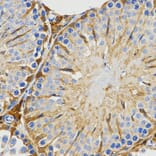 Immunohistochemistry - PIWIL4 antibody from Signalway Antibody (38601) - Antibodies.com