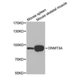 Western blot - DNMT3A antibody from Signalway Antibody (38611) - Antibodies.com