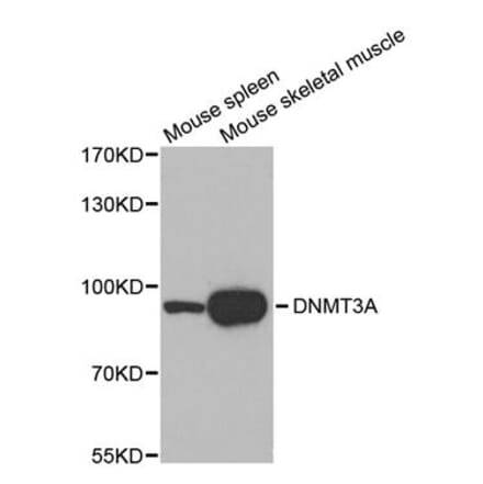 Western blot - DNMT3A antibody from Signalway Antibody (38611) - Antibodies.com