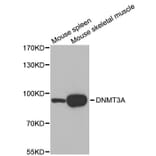Western blot - DNMT3A antibody from Signalway Antibody (38611) - Antibodies.com