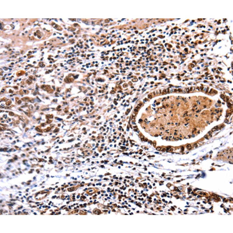 Immunohistochemistry - DNMT3A antibody from Signalway Antibody (38611) - Antibodies.com