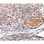 Immunohistochemistry - DNMT3A antibody from Signalway Antibody (38611) - Antibodies.com