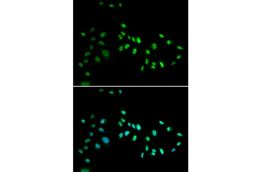 Immunofluorescence - DNMT3A antibody from Signalway Antibody (38611) - Antibodies.com
