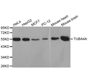 Western blot - TUBA4A antibody from Signalway Antibody (38626) - Antibodies.com