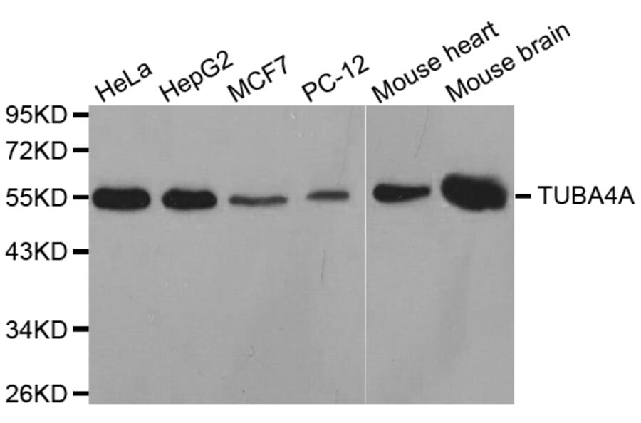 Western blot - TUBA4A antibody from Signalway Antibody (38626) - Antibodies.com