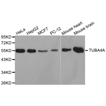 Western blot - TUBA4A antibody from Signalway Antibody (38626) - Antibodies.com