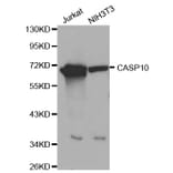 Western blot - CASP10 antibody from Signalway Antibody (39203) - Antibodies.com