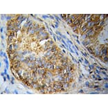 Immunohistochemistry - CASP10 antibody from Signalway Antibody (39203) - Antibodies.com