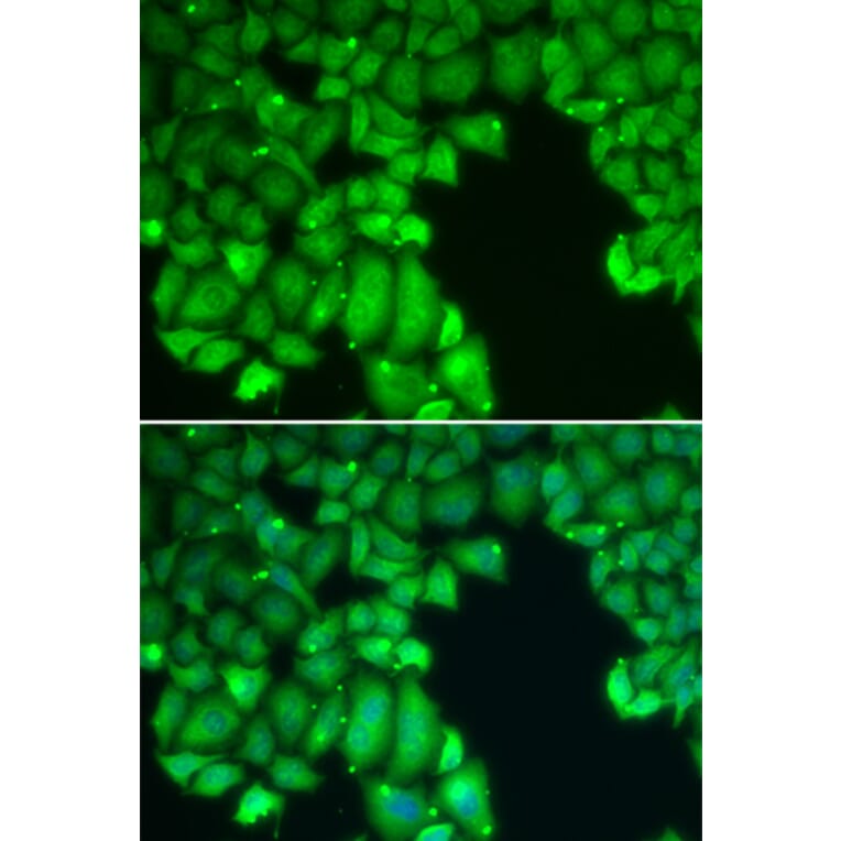 Immunofluorescence - CASP10 antibody from Signalway Antibody (39203) - Antibodies.com