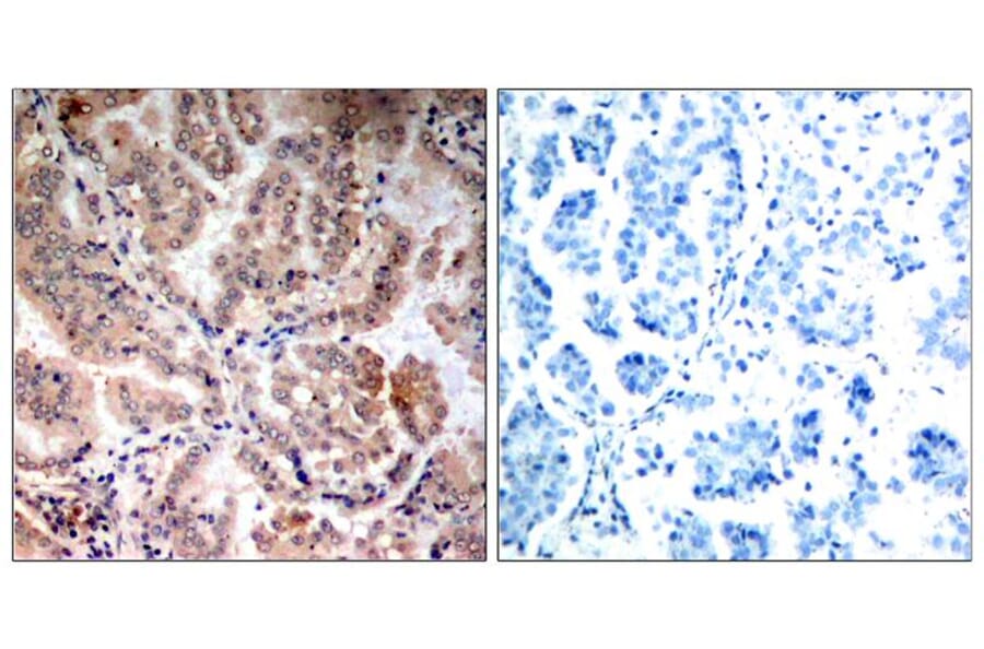 Immunohistochemistry - AMPKa1/AMPKa2 (Ab-174/172) Antibody from Signalway Antibody (21191) - Antibodies.com