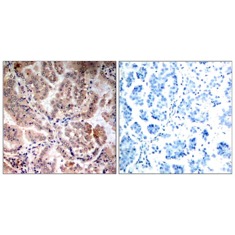 Immunohistochemistry - AMPKa1/AMPKa2 (Ab-174/172) Antibody from Signalway Antibody (21191) - Antibodies.com