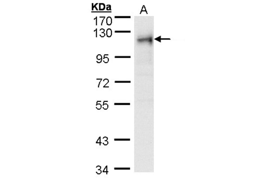 ribosome binding protein 1 antibody from Signalway Antibody (22033) - Antibodies.com