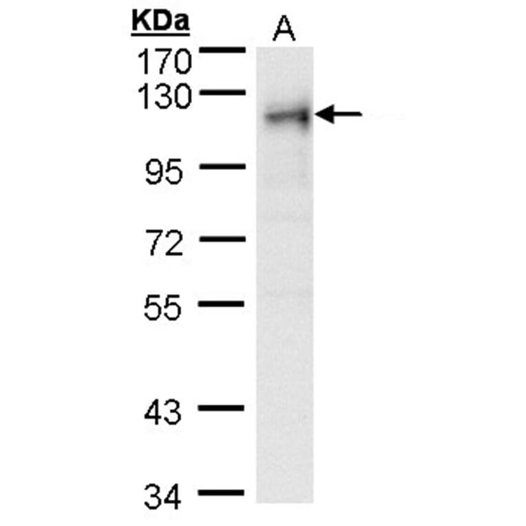 ribosome binding protein 1 antibody from Signalway Antibody (22033) - Antibodies.com