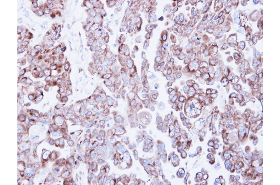 Immunohistochemistry - ribosome binding protein 1 antibody from Signalway Antibody (22033) - Antibodies.com