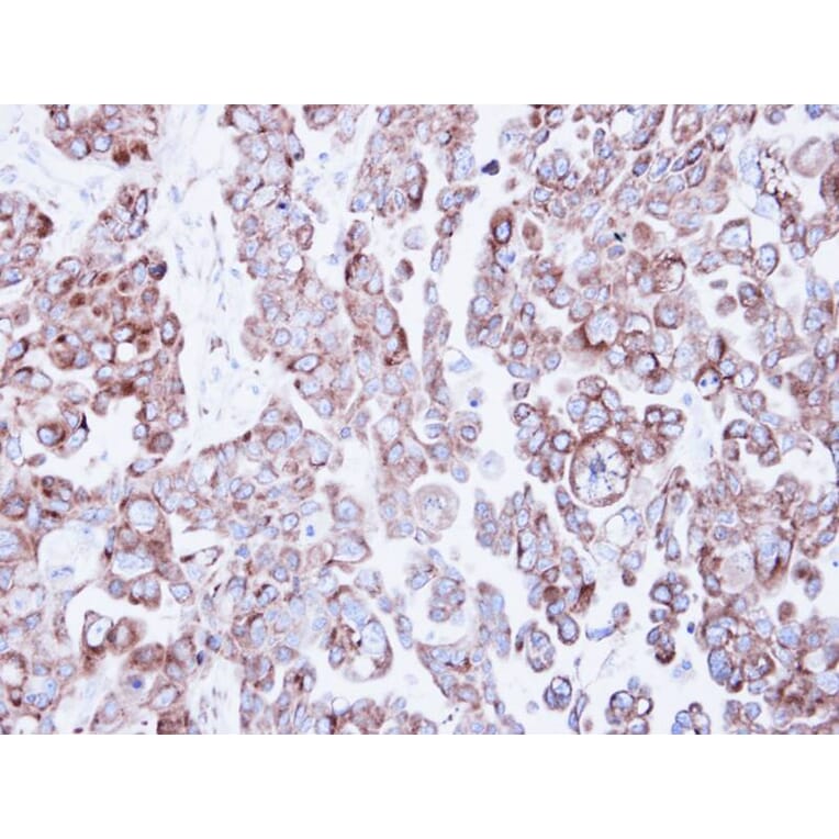 Immunohistochemistry - ribosome binding protein 1 antibody from Signalway Antibody (22033) - Antibodies.com