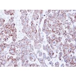 Immunohistochemistry - ribosome binding protein 1 antibody from Signalway Antibody (22033) - Antibodies.com