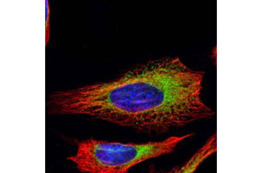ribosome binding protein 1 antibody from Signalway Antibody (22033) - Antibodies.com