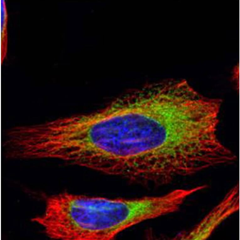 ribosome binding protein 1 antibody from Signalway Antibody (22033) - Antibodies.com