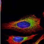 ribosome binding protein 1 antibody from Signalway Antibody (22033) - Antibodies.com