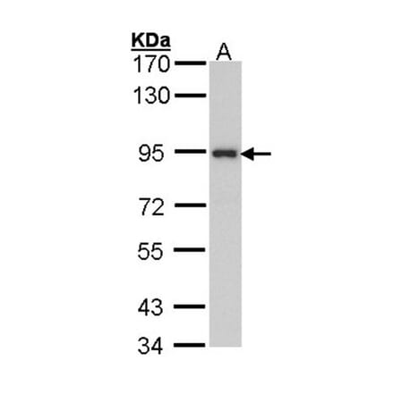 ribosome binding protein 1 antibody from Signalway Antibody (22035) - Antibodies.com