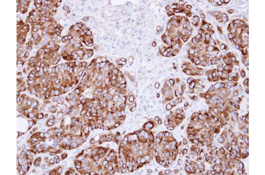 Immunohistochemistry - ribosome binding protein 1 antibody from Signalway Antibody (22035) - Antibodies.com