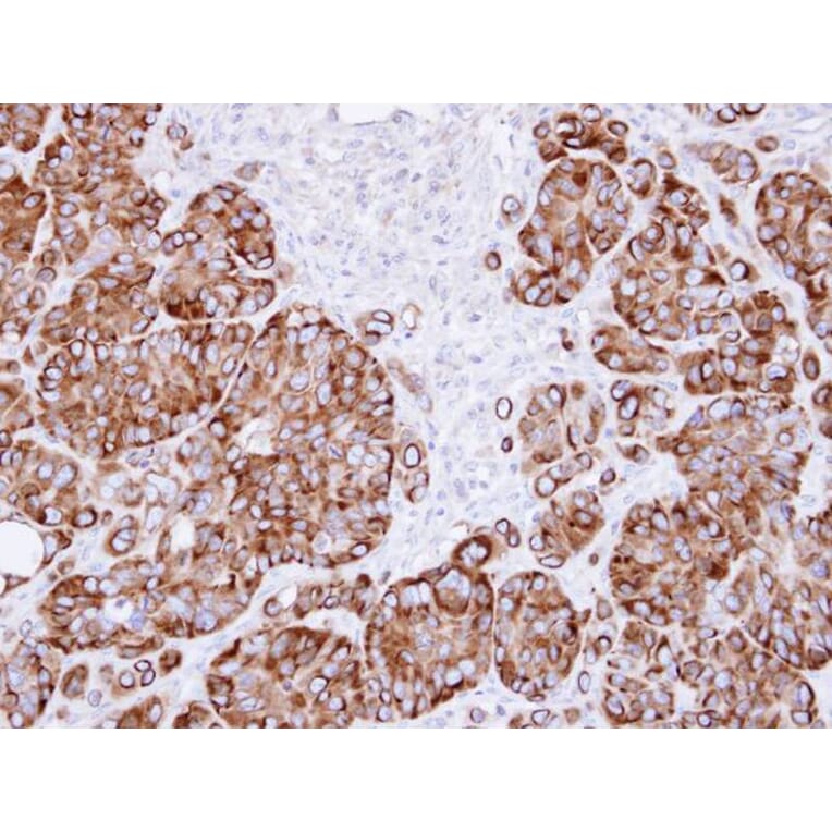 Immunohistochemistry - ribosome binding protein 1 antibody from Signalway Antibody (22035) - Antibodies.com