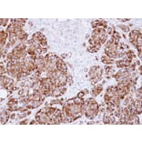 Immunohistochemistry - ribosome binding protein 1 antibody from Signalway Antibody (22035) - Antibodies.com