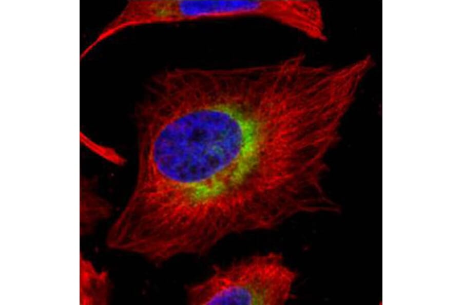 ribosome binding protein 1 antibody from Signalway Antibody (22035) - Antibodies.com