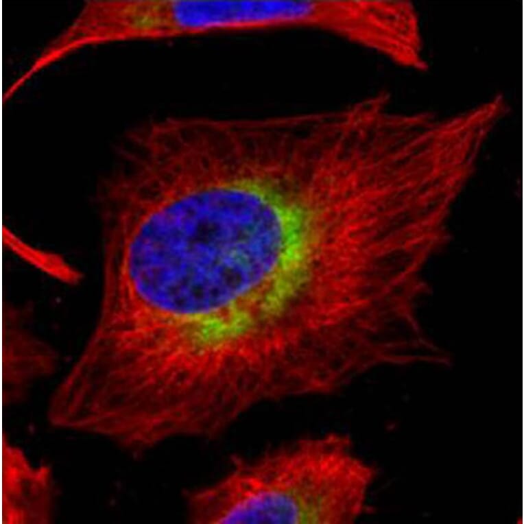 ribosome binding protein 1 antibody from Signalway Antibody (22035) - Antibodies.com