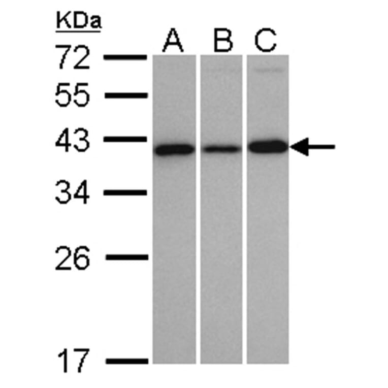 Vps20-associated 1 homolog antibody from Signalway Antibody (22529) - Antibodies.com