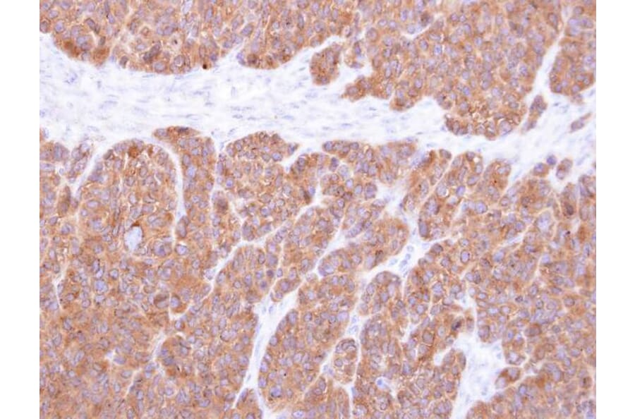 Immunohistochemistry - Vps20-associated 1 homolog antibody from Signalway Antibody (22529) - Antibodies.com