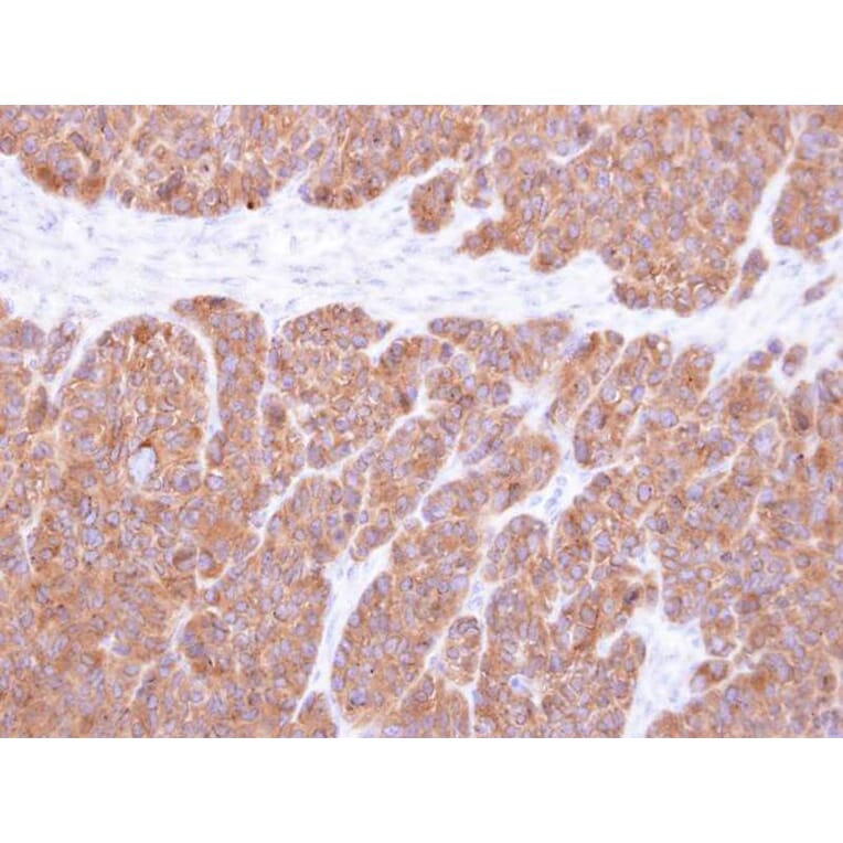 Immunohistochemistry - Vps20-associated 1 homolog antibody from Signalway Antibody (22529) - Antibodies.com
