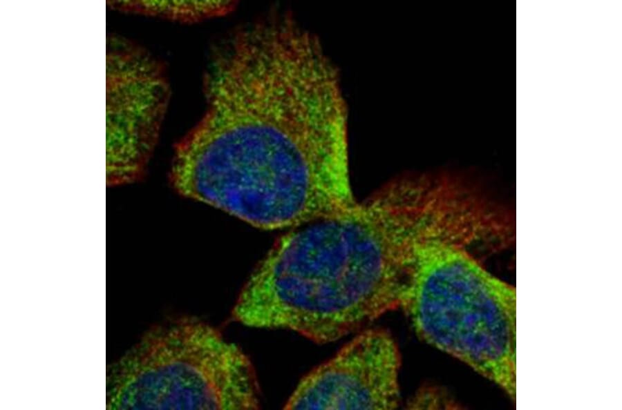 Vps20-associated 1 homolog antibody from Signalway Antibody (22529) - Antibodies.com