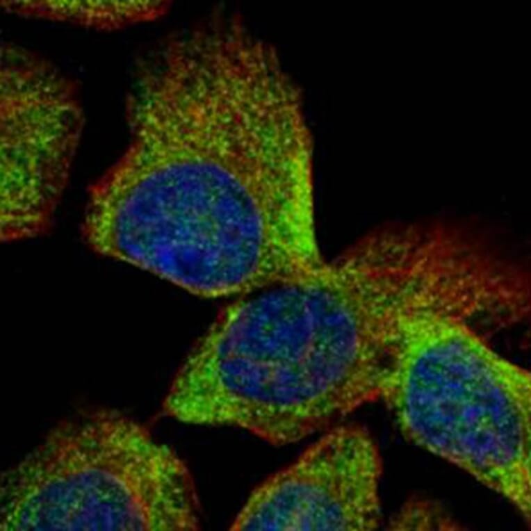 Vps20-associated 1 homolog antibody from Signalway Antibody (22529) - Antibodies.com