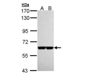 Pyruvate Kinase (liver/RBC) antibody from Signalway Antibody (22570) - Antibodies.com