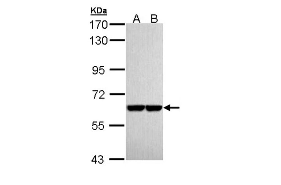 Pyruvate Kinase (liver/RBC) antibody from Signalway Antibody (22570) - Antibodies.com