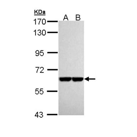 Pyruvate Kinase (liver/RBC) antibody from Signalway Antibody (22570) - Antibodies.com