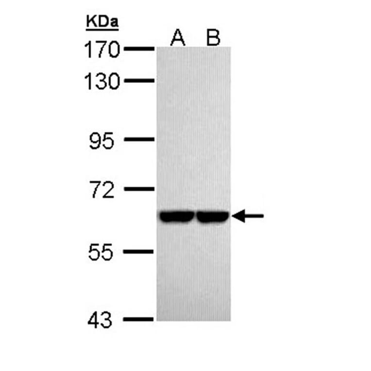 Pyruvate Kinase (liver/RBC) antibody from Signalway Antibody (22570) - Antibodies.com