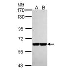 Pyruvate Kinase (liver/RBC) antibody from Signalway Antibody (22570) - Antibodies.com