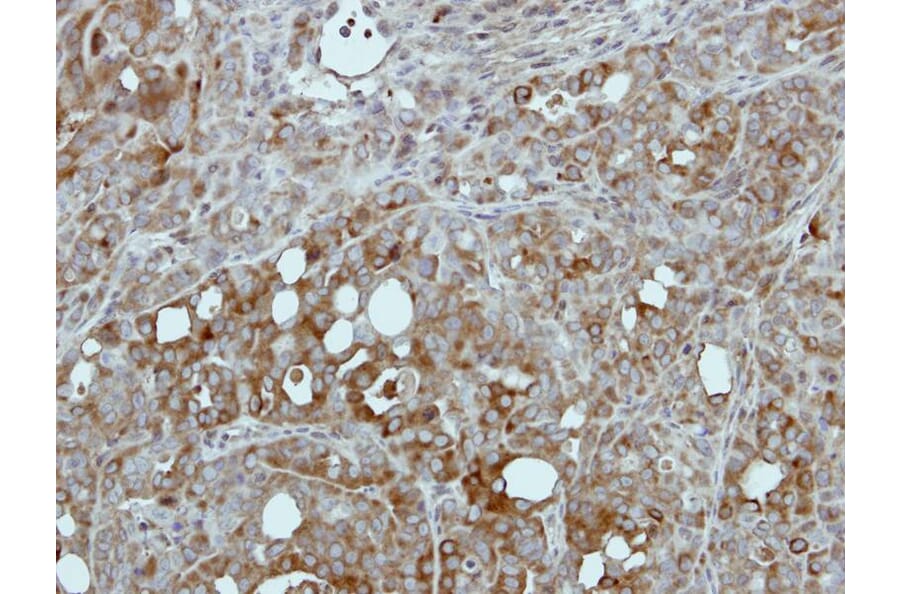 Immunohistochemistry - Pyruvate Kinase (liver/RBC) antibody from Signalway Antibody (22570) - Antibodies.com