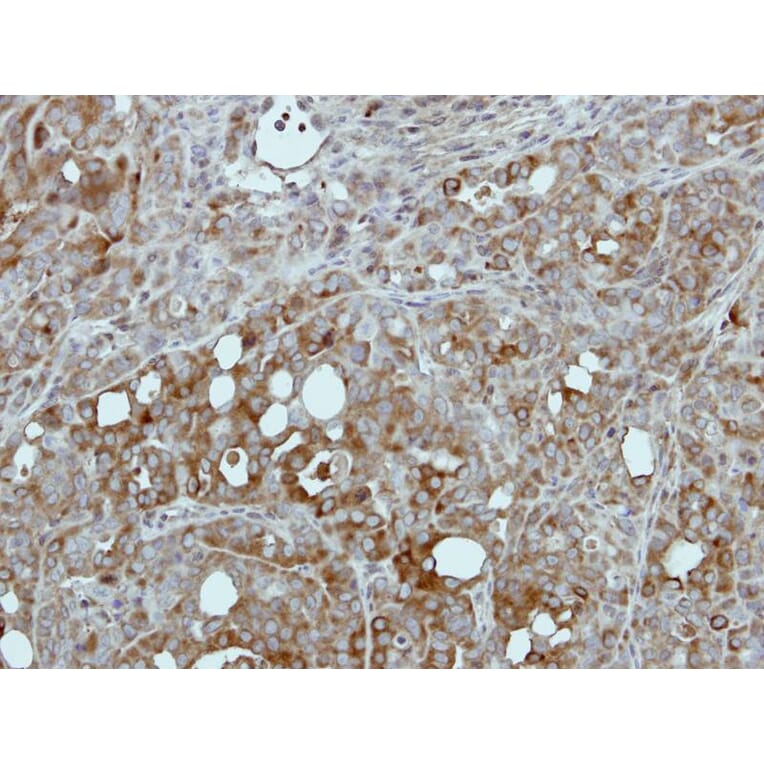Immunohistochemistry - Pyruvate Kinase (liver/RBC) antibody from Signalway Antibody (22570) - Antibodies.com